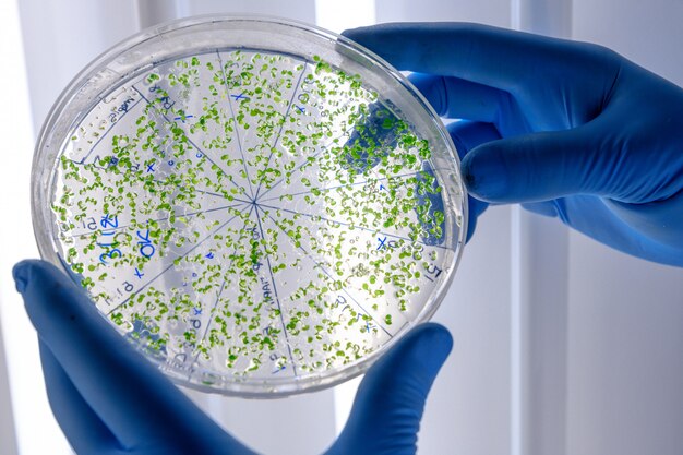 Microbioma, desnutrición y terapias de donantes para la salud infantil en comunidades vulnerables